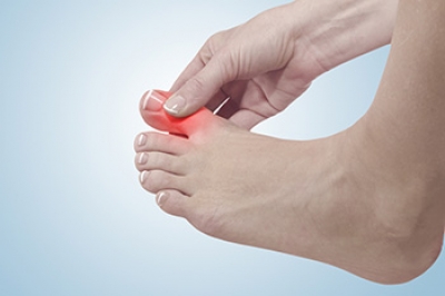 Gout Symptoms and the Importance of Early Treatment